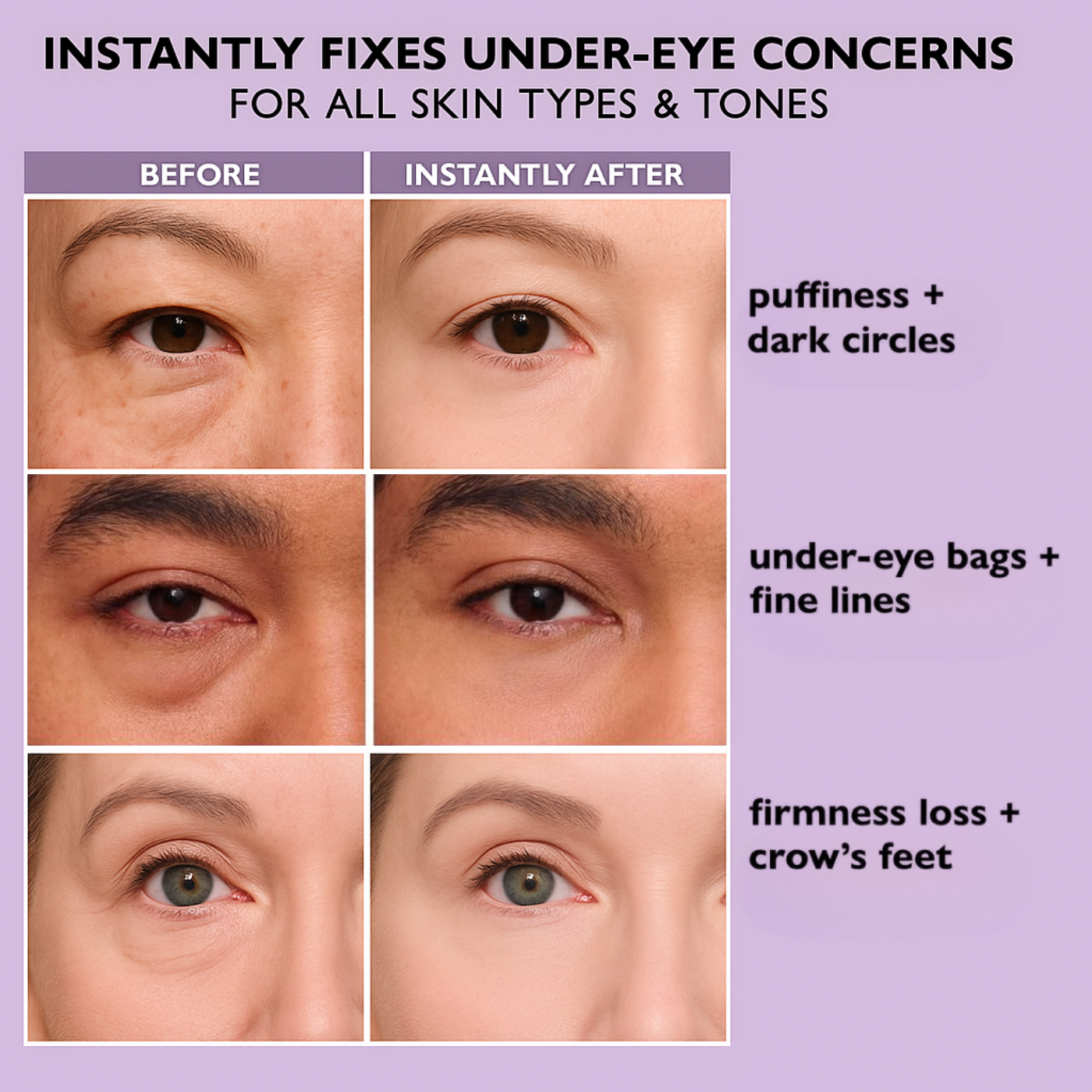 Cerava Eye Tightener V2