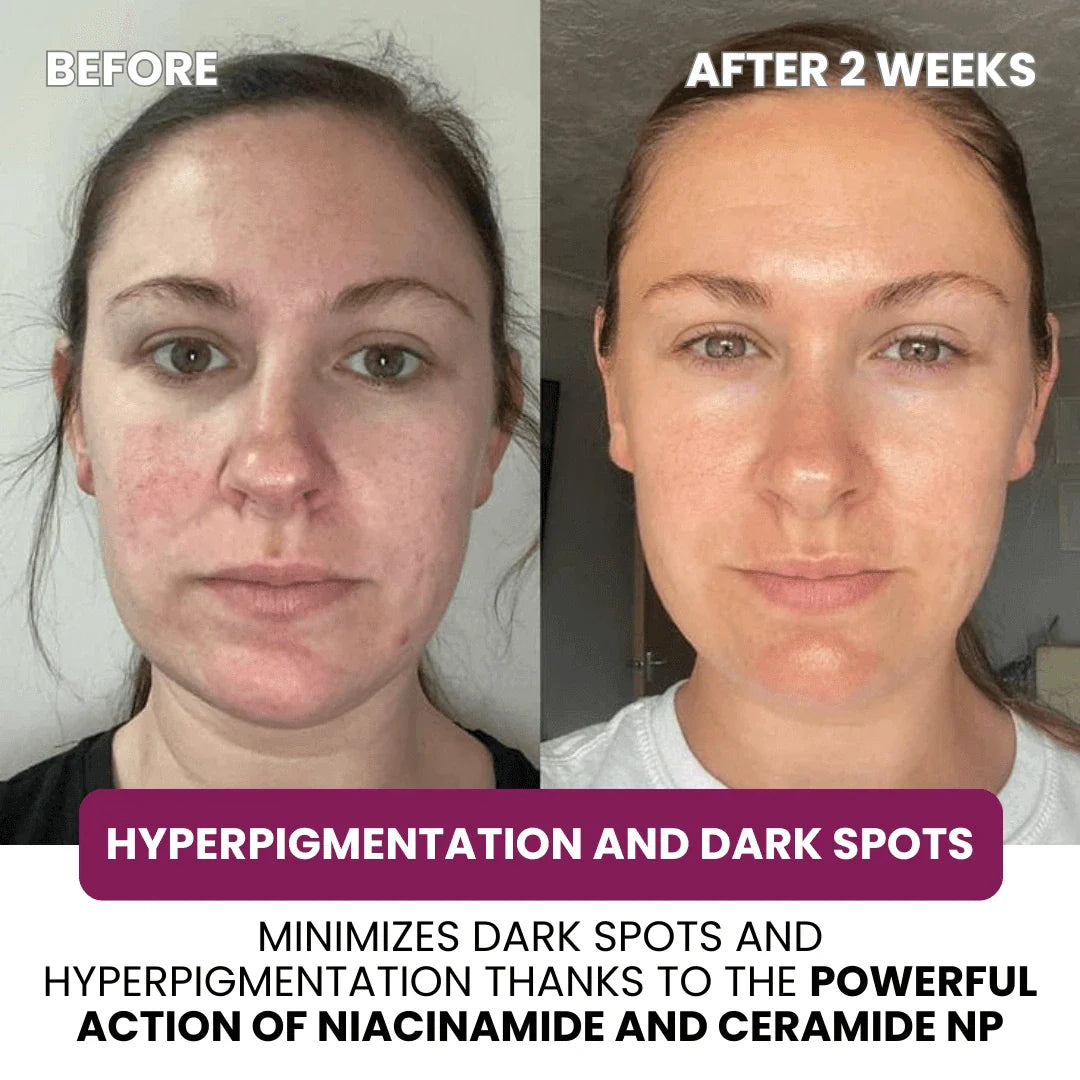 Cerava Collagen Mask