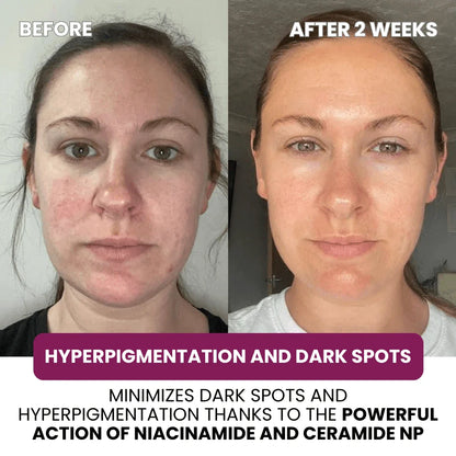 Cerava Collagen Mask